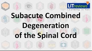 Subacute Combined Degeneration of the Spinal Cord [upl. by Herby]