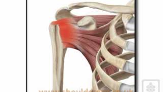 subacromial impingement aetiologymp4 [upl. by Benjie]