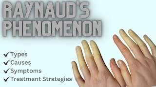 Raynauds Phenomenon Types Causes Symptoms and Treatment Strategies [upl. by Aihsekel]