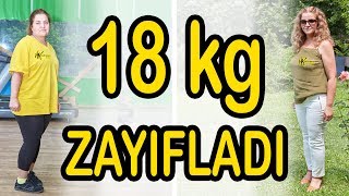 6 Yıl Bir Gram Zayıflayamadı HK Zayıflama Kampına Geldi 18 Kilo Zayıfladı [upl. by Jaret]