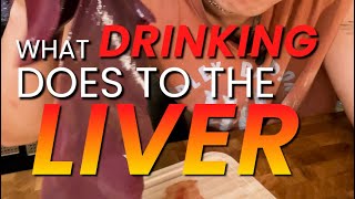 What Drinking Does To Your Liver [upl. by Rise]