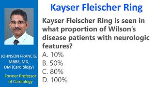 Kayser Fleischer Ring [upl. by Clougher41]