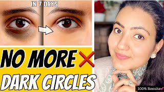 Remove DARK CIRCLES Permanently In 7 Days  100 Results [upl. by Vange859]