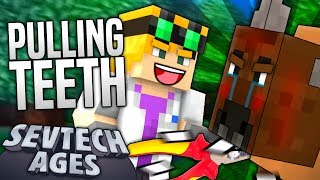 Minecraft  PULLING TEETH  SevTech Ages 17 [upl. by Oflodur]