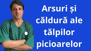 Arsuri și căldură ale tălpilor picioarelor [upl. by Ruzich]