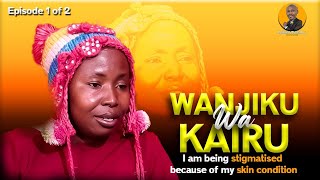 I AM BEING STIGMATIZED BECAUSE OF MY SKIN CONDITION  WANJIKU WA WAKAIRU [upl. by Irep]