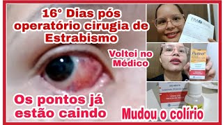 16° Dias da cirurgia de Estrabismoos pontos estão caindo Voltei no médico  a Dor acabou🙌 [upl. by Calderon]