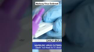 Marburg VIRUS outbreak in Rwanda currentevents newsupdate Rwanda marburgvirus [upl. by Duile]