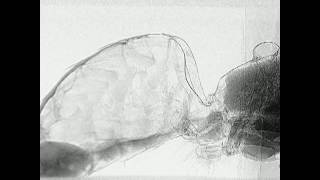 Folded Intersegmental Membrane FIM in a Honey Bee Abdomen [upl. by Holtz]