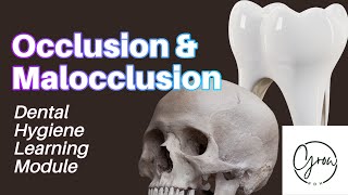 Occlusion and Malocclusion A Dental Hygiene Learning Module [upl. by Bride]