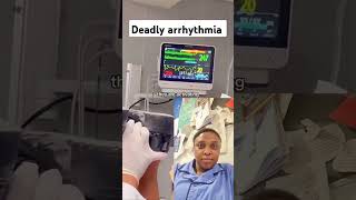 Deadly arrhythmia highlights [upl. by Horvitz]