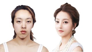 Top 5 Drastic Korean Plastic Surgery TV Show Transformations  Seoul Guide Medical [upl. by Golightly624]