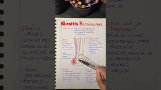 Bursitis retrocalcanea [upl. by Llenrub287]