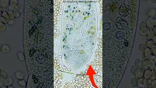 White Blood Cells Fight With Germs science sciencefacts [upl. by Medovich]