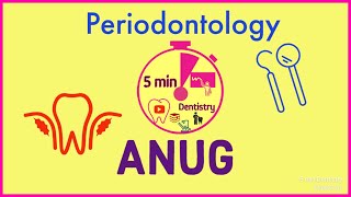 ANUG  GINGIVAL INFECTION  PERIODONTICS  Quick notes from 5 min DENTISTRY [upl. by Ialocin]