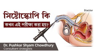 সিস্টোস্কোপি কি এই পরীক্ষা কখন করা হয়  What is cystoscopy why cystoscopy test is used for [upl. by Aneed]