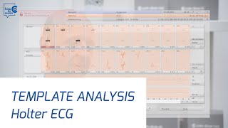 Holter ECG with custo diagnosticPart 3 template analysis [upl. by Barbuto15]