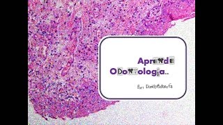 Lesiones de la mucosa  Patología oral [upl. by Nired929]