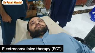 Electroconvulsive therapy ECT foryou foryourpage millions medical [upl. by Ahsiet]