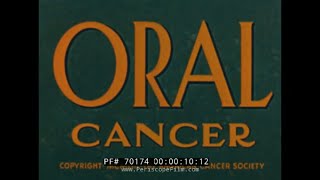 1949 AMERICAN CANCER SOCIETY FILM “ ORAL CANCER THE PROBLEM OF EARLY DIAGNOSIS ” 70174 [upl. by Christianna369]