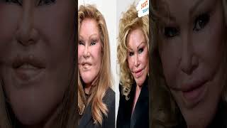 Jocelyn Wildenstein JocelynWildenstein catwoman SurgeryAddiction beauty celebritynews [upl. by Adnara]