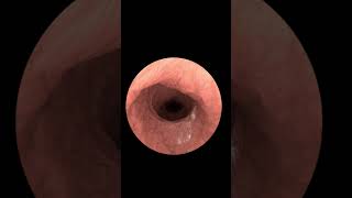 Exploring Your Insides with Gastrointestinal Endoscopy Animation 2024 [upl. by Remmer]