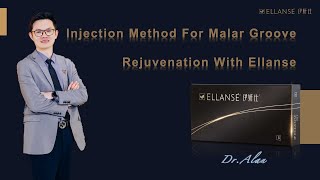 Rejuvenation With Ellanse  Innovative Injection Method  Malar Groove  Professional Sharing [upl. by Comyns607]