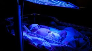 phototherapy for neonatal jaundice newborn baby cutebaby [upl. by Hoxie]