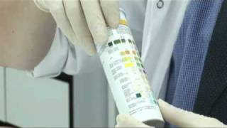 Urine Analysis [upl. by Lamraj]