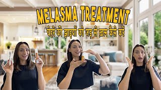 How to treat melasma  with laser treatment or without laser treatment [upl. by Betti74]