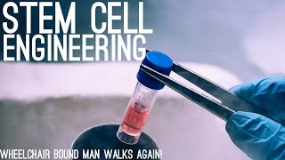 Wheelchairbound Man Walks Again After Stem Cell Injections [upl. by Africa]