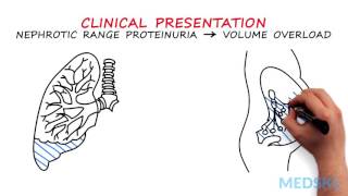 Nephrology – Proteinuria By Manish Suneja MD [upl. by Cowie]