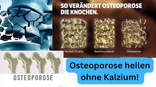 Osteoporose ist KEIN Kalziumproblem [upl. by Ardiek]