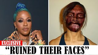 20 Black celebrities Who RUINED Their Careers With PLASTIC SURGERY [upl. by Darcia]