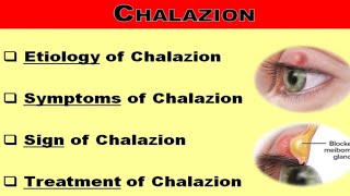 Chalazion [upl. by Acirred]