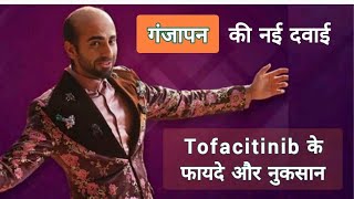 गंजापन की नई दवाई Tofacitinib के फायदे और नुकसान  Alopecia Areata का इलाज alopecia hairfall [upl. by Ecined637]