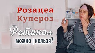 Ретинол и чувствительная кожа  Подходы и исследования  Розацеа или купероз  Ниацинамид и др [upl. by Ydeh]