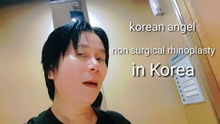 korean angel my nose non surgical rhinoplasty experience in korea [upl. by Martinic48]