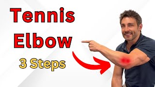 3 Steps To LONGTERM Tennis Elbow Relief [upl. by Annel]