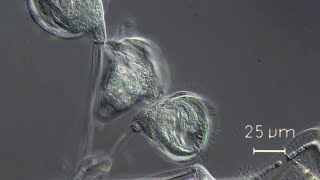 Carchesium sp a peritrichous protozoan [upl. by Nwahs]