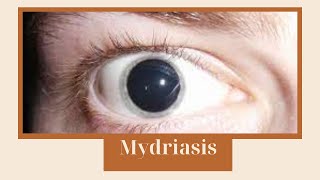 Causes of mydriasis  Ocular signs [upl. by Lluj745]