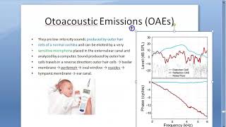 ENT OAE Otoacoustic Emissions Outer hair cells infant hearing test spontaneous evoked distorted [upl. by Leigha]