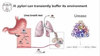 Gastritis H Pylori Persistence [upl. by Aihsas]