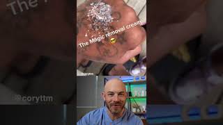 Magic tattoo removal cream🤔 dermreacts tattooremoval diytattooremoval doctorreacts [upl. by Garris]