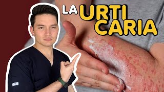 Tratamiento para la urticaria urticaria saluddelapiel alergia [upl. by Neelyhtak]