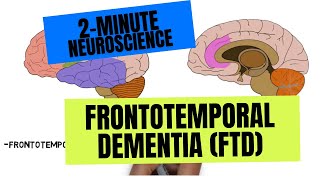 2Minute Neuroscience Frontotemporal Dementia FTD [upl. by Atisusej259]