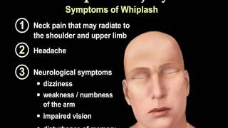 Whiplash Injury Animation  Everything You Need to Know  Dr Nabil Ebraheim MD [upl. by Eggleston]