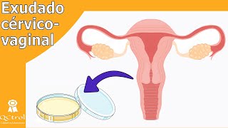 Cultivo cérvico  vaginal TOMA DE MUESTRA y patógenos [upl. by Billye]