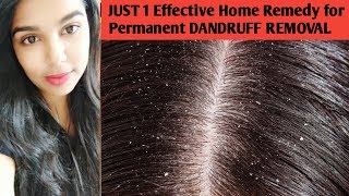 Best Home remedies for dandruff in tamil  dandruff removal treatment in tamil  hairgrowthtips [upl. by Oicafinob]