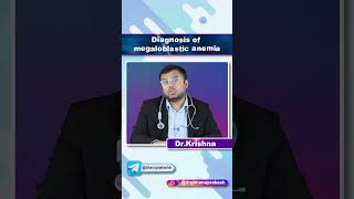 Diagnosis Of Megaloblastic Anemia  Quick Bites Internal medicine Hematology [upl. by Geddes]